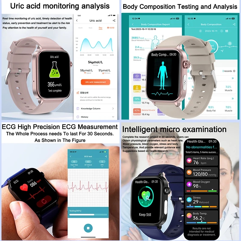 2025 New For XIAOM1 ECG+PPG Bl - đánh giá và giá Smart Home Energy Management